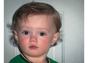 Baby Bones Before
